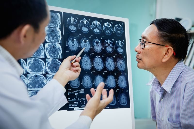 Minorities Miss Out on Brain-Imaging Studies for Alzheimer's