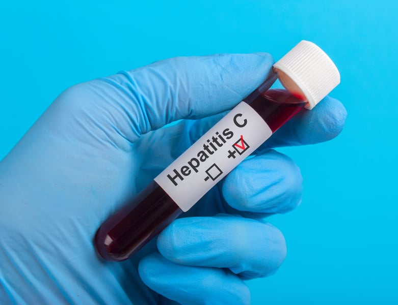 There's No Hepatitis C Vaccine, But You Can Still Prevent Infection