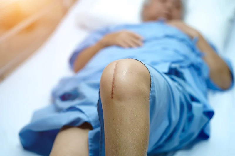 Extra Antibiotic With Hip, Knee Replacement Won`t Prevent Infections: Study