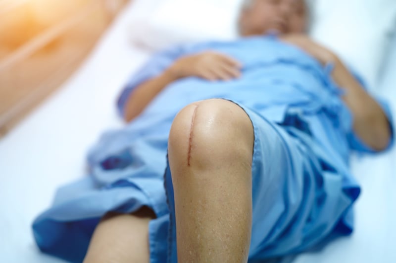 Extra Antibiotic With Hip, Knee Replacement Won`t Prevent Infections: Study
