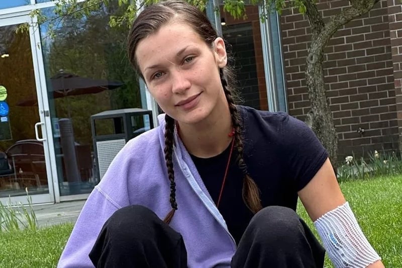 Bella Hadid Opens Up About Lyme Disease Battle