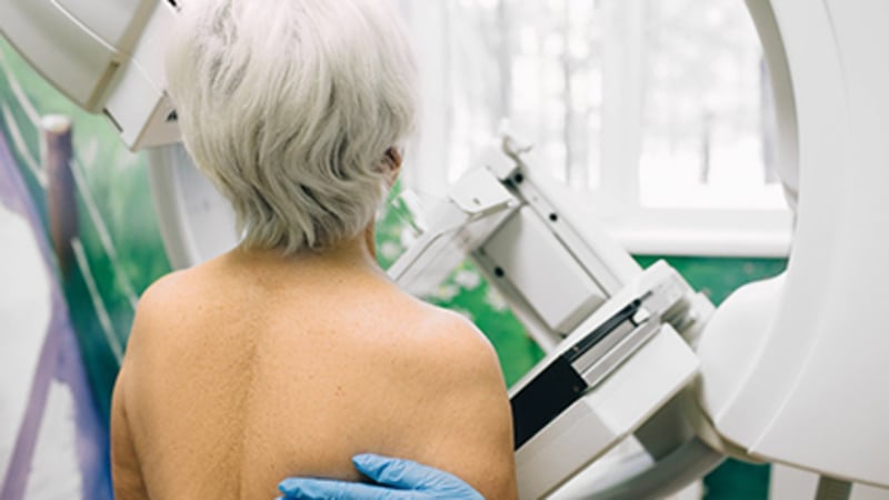 Mammography After 70, Do the Benefits Outweigh the Risks?